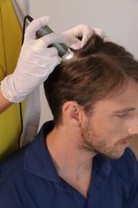 Hair Restoration Results